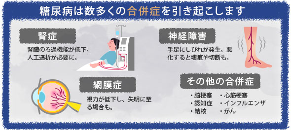 糖尿病は数多くの合併症を引き起こします