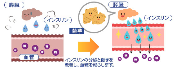 インスリンの機能を回復させる